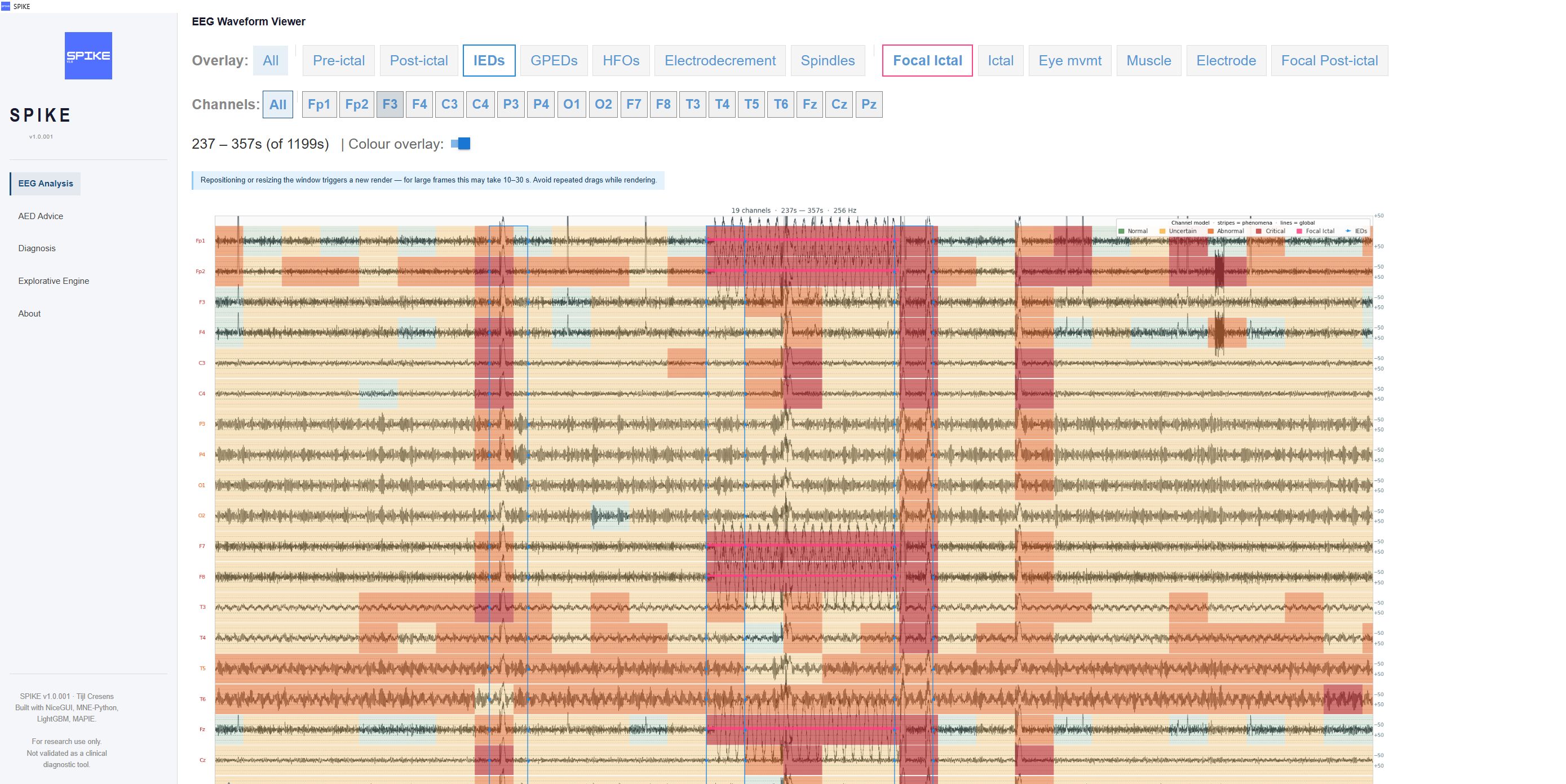 SPIKE — EEG-analyse